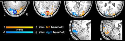 Temporal Information Entropy of the Blood-Oxygenation Level-Dependent Signals Increases in the Activated Human Primary Visual Cortex